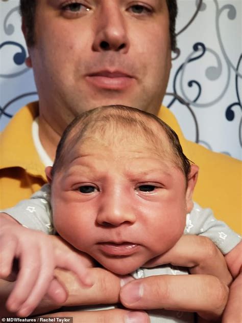 Mother Of Baby Boy Born With A Tiny Head Reveals Doctors Thought Her