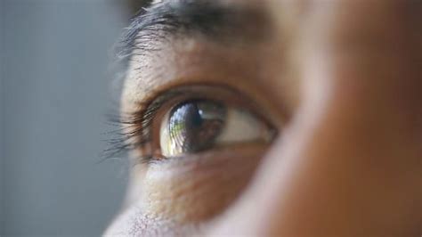 What Do Blind Peoples Eyes Look Like