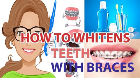 You can bleach your teeth after braces with all the similar modalities as if you didn't have braces. How to Whiten Teeth With Braces | How to Whiten Teeth With ...