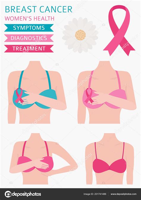 Breast Cancer Medical Infographic Diagnostics Symptoms Treatment Women Health Set Stock Vector
