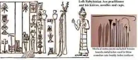 Los tratamientos médicos en la antigua Mesopotamia