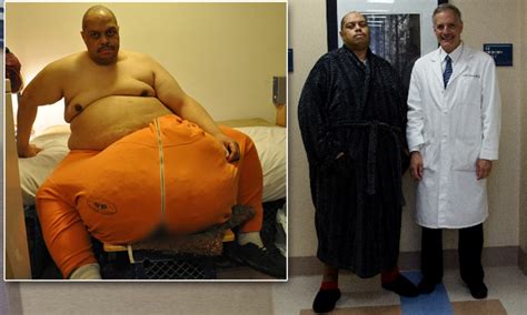 Wesley Warren Jr Man Who Had 132lbs Scrotum Removed Is Finally Optimistic About The Future