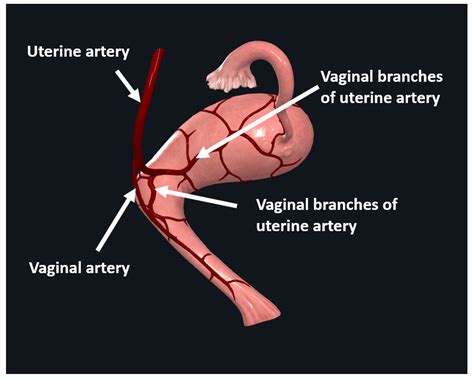 Anatomy Of The Uterus Female Reproductive Anatomy Geeky Medics