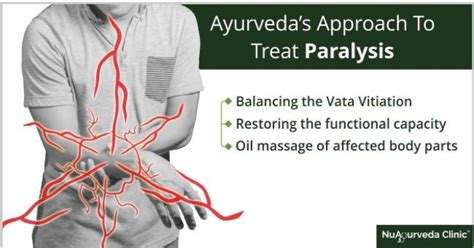 ayurvedic treatment for paralysis ayurvedic treatment nuayurveda clinic mumbai id 19157433730