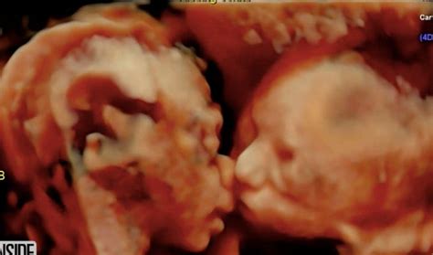 Couple Says They See Jesus In Sonogram Looking At Baby Huffpost