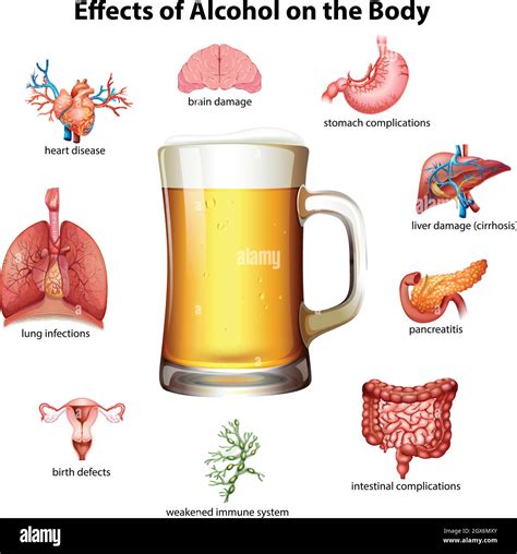 Effects Of Alcohol On The Body Stock Vector Image And Art Alamy