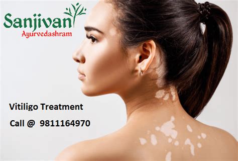 Useful Tips From Experts In Vitiation Treatment Sanjivani Ayurvedashram