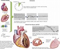 Sudden Cardiac Death | Thoracic Key