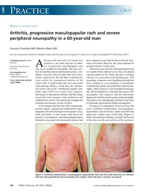 Pdf Arthritis Progressive Maculopapular Rash And Severe Peripheral