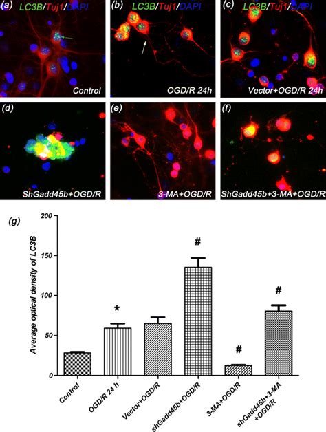 The Immunofluorescent Staining Results Of Tuj1 And Lc3b Cultured