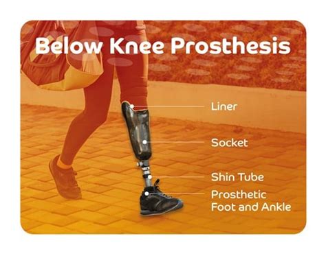 below knee prosthetic limbs