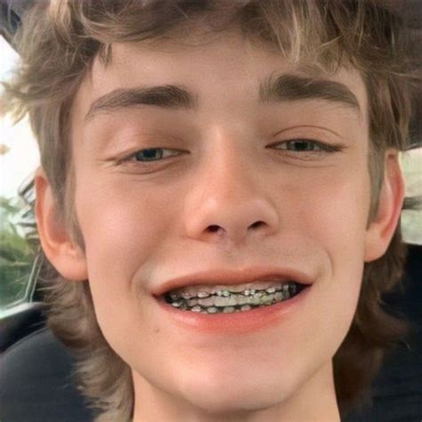 Pin By John Beeson On Guys In Braces In Pretty Face Guys With Braces Pretty People