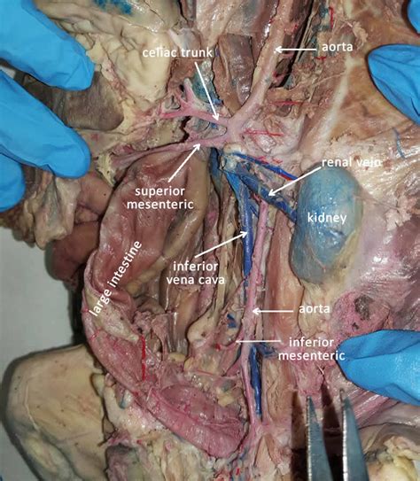 These vessels transport blood cells, nutrients, and oxygen to the tissues of the body. Celiac Trunk