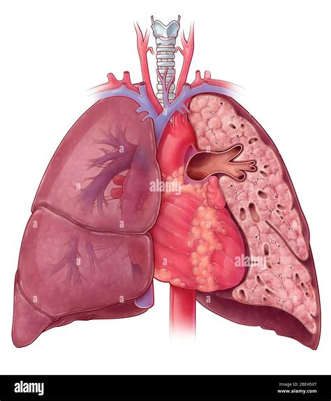Anatomie Du Cœur Et Du Poumon Illustration Photo Stock Alamy