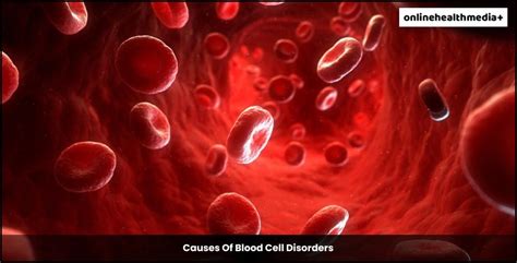 What Are Blood Cell Disorders Symptoms Treatment And Prevention