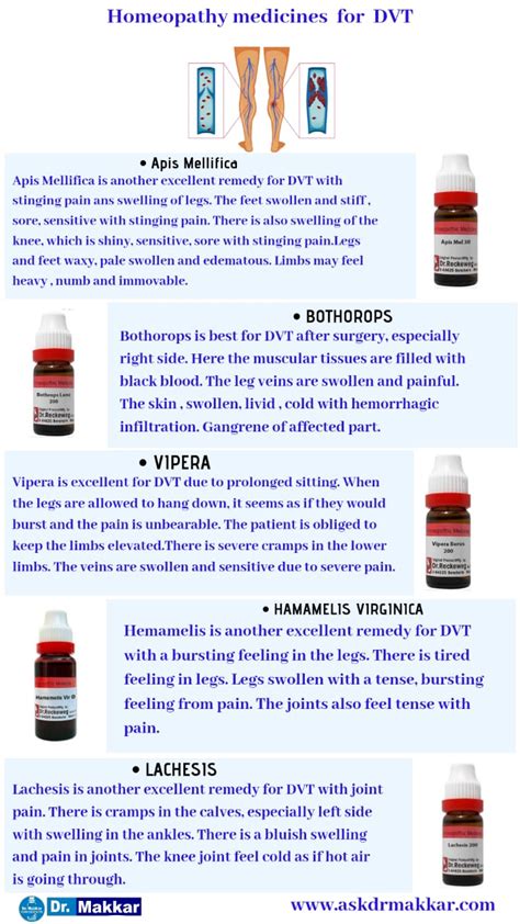 Deep Vein Thrombosis Dvt Causes Symptom Homeopathic Treatment