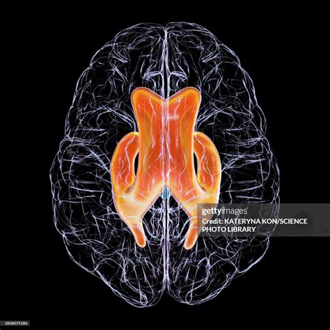 Enlarged Lateral Ventricles Of The Brain Illustration High Res Vector
