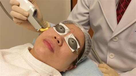 Laser Facial Treatment Skincentral Dermatology Aesthetics And Lasers