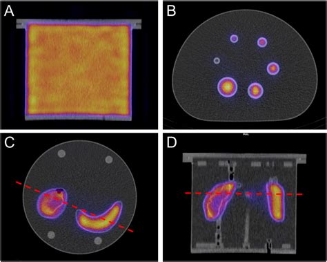 Multicentre Trials On Standardised Quantitative Imaging And Dosimetry
