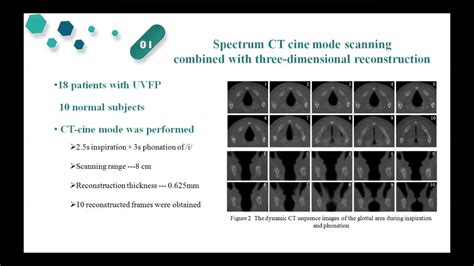 The Application Of Dynamic Ct Scan In Evaluating The Dynamic Changes Of