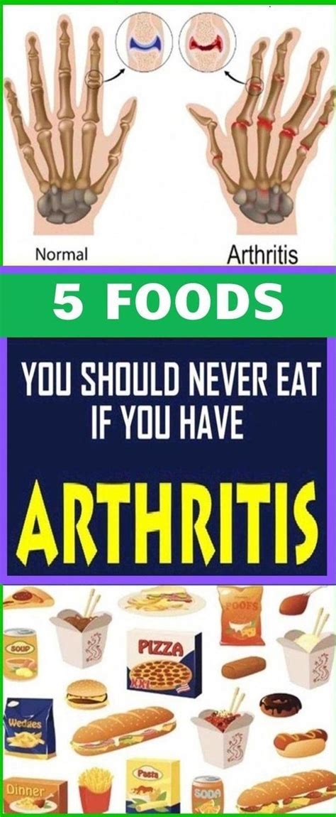 5 Foods You Should Never Eat If You Have Arthritis Arthritis