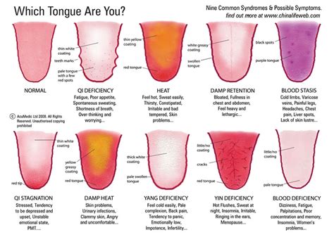 Tongue Diagnosis And Tips For Healthy Living