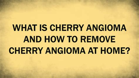 Ppt What Is Cherry Angioma And How To Remove Cherry Angioma At Home