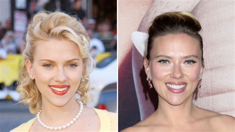 Did Scarlett Johansson Get Plastic Surgery Then Now Photos Life And Style