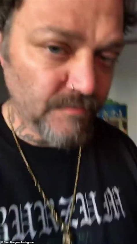 Bam Margera Admits To Considering Suicide As He Begs Fans To Boycott