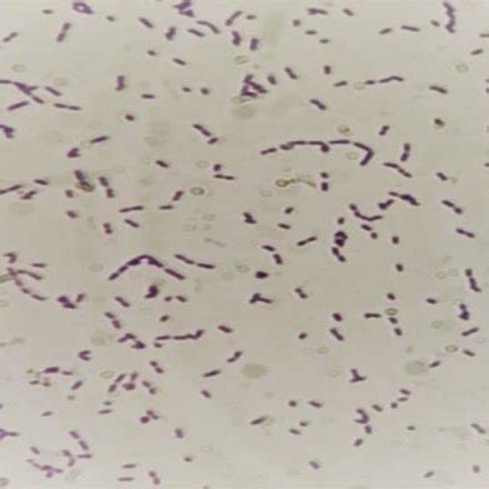 Characteristics Feature Of Listeria Monocytogenes Colony On Palcam