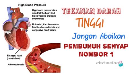 Darah rendah adalah kondisi tekanan pada darah yang dihasilkan saat jantung memompa darah ke seluruh tubuh berada di bawah batas tekanan normal. Cara Ubat Tekanan Darah Rendah - Idola O
