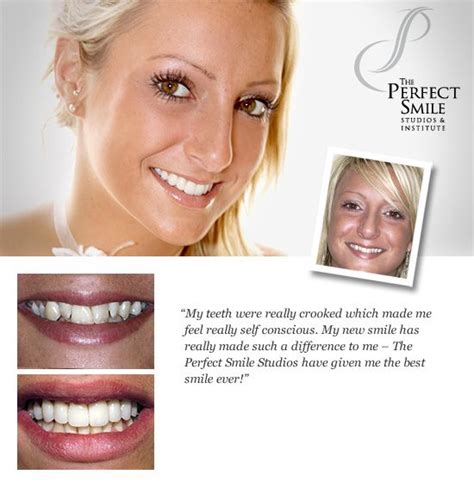 Cosmetic Dentistry And Implants Centre Hertfordshire Tps Cosmetic