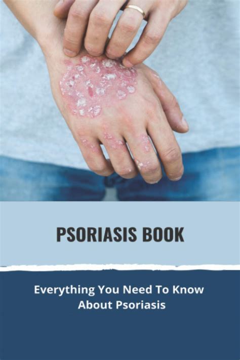 Buy Psoriasis Book Everything You Need To Know About Psoriasis