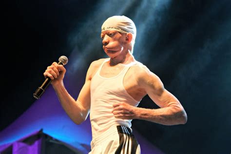 Scorned Dancehall Star Yellowman Is Still Facing Racism Dancehallmag