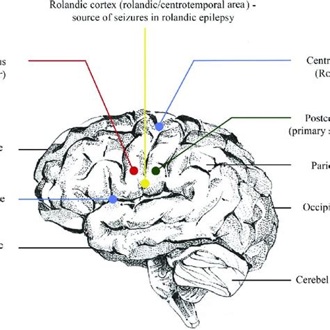 Pdf Benign Epilepsy With Centrotemporal Spikes Current Concepts Of