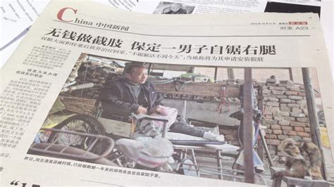 China Man Amputates His Own Leg With Saw World News Sky News