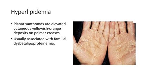 Ppt Cutaneous Manifestations Of Systemic Disease Powerpoint