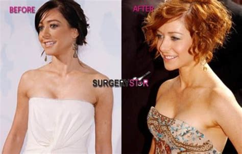 Celebrity Alyson Hannigan Plastic Surgery Celeb Surgerycom