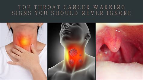 Top Throat Cancer Warning Signs You Should Never Ignore