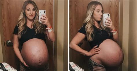 Mom Documents Reality Of Giving Birth To Quadruplets With Before And After Photos