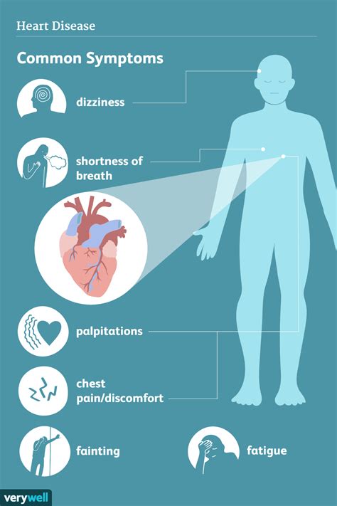 Heart Disease Signs Symptoms And Complications 48 Off