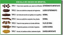 Escala de heces de Bristol - Wikipedia, la enciclopedia libre