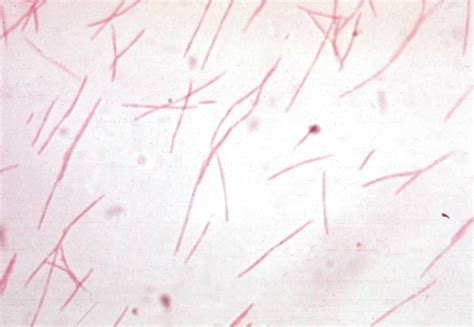 Gram Negative Bacilli Rods Microbiology Learning The Whyology Of