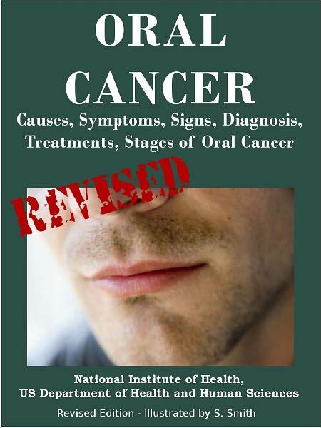 Oral Cancer Causes Symptoms Signs Diagnosis Treatments Stages Of