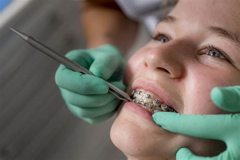 Orthodontiepraktijk Leeuwarden Vaste Apparatuur Orthodontiepraktijk Leeuwarden
