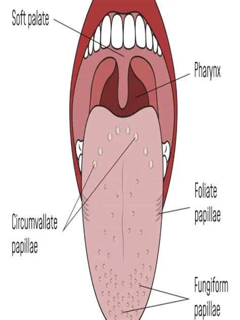 Transient Eruptive Lingual Papillitis On Tongue After