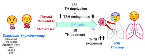 Schematic Representation Of Radioactive Iodide Rai Therapy In