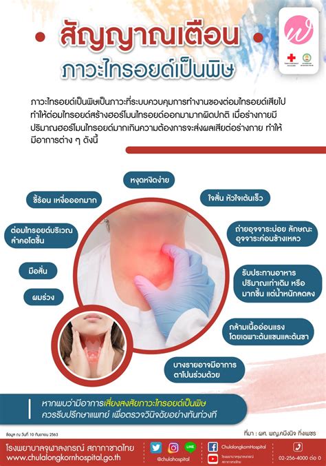สัญญาณเตือน ภาวะไทรอยด์เป็นพิษ - โรงพยาบาลจุฬาลงกรณ์ สภากาชาดไทย