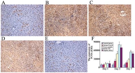 Expression Of Proliferating Cell Nuclear Antigen Pcna In Liver Tissue