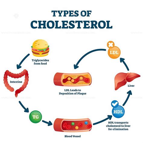 Types Of Cholesterol Educational Cycle Scheme From Fatty Food To Ldl